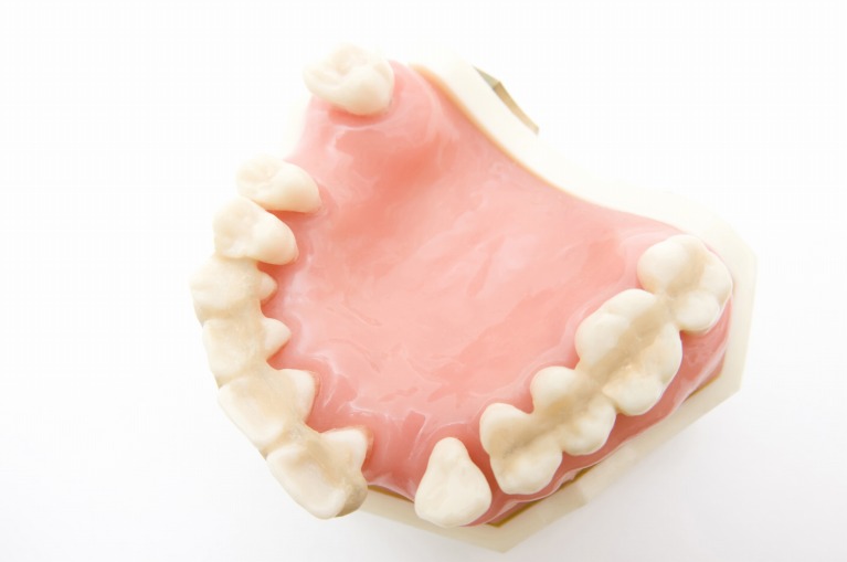 歯周内科治療の意義